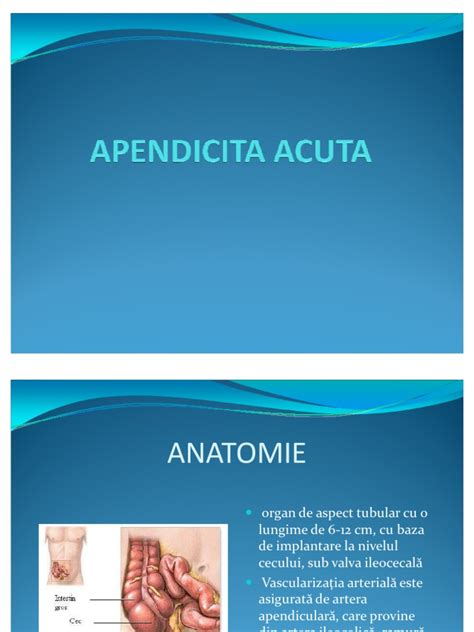 apendicita acuta|Apendicita acută 